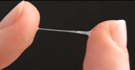 اسباب نزول افرازات بيضاء للحامل